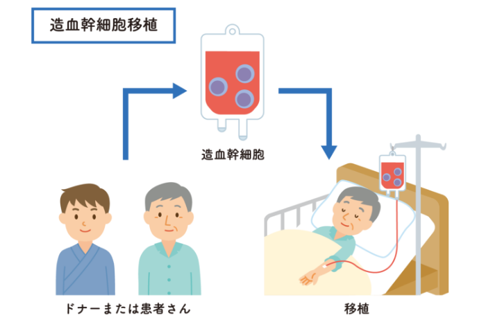 造血幹細胞移植