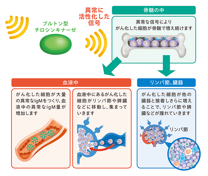 イムブルビカ®投与前のWM/LPL